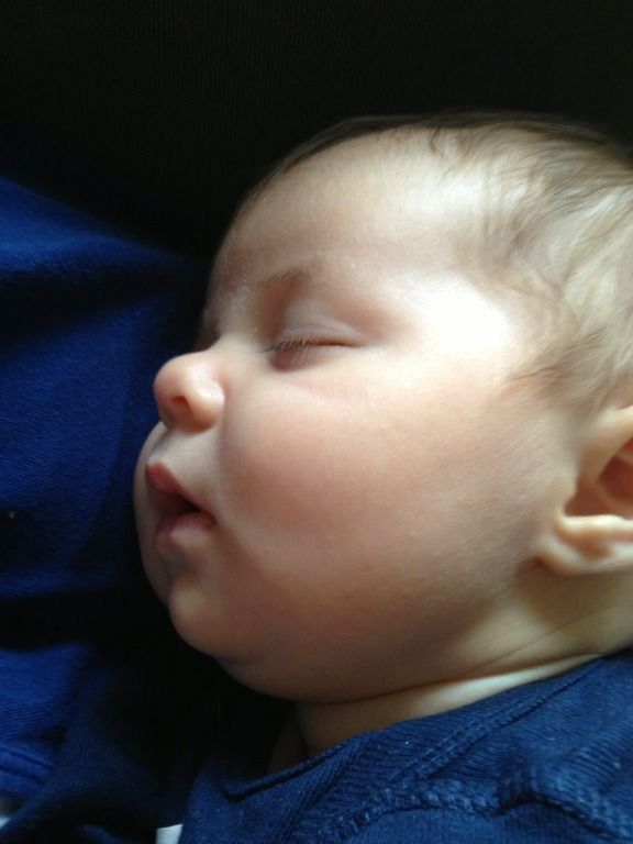 Recessed chin (pics) BabyCenter