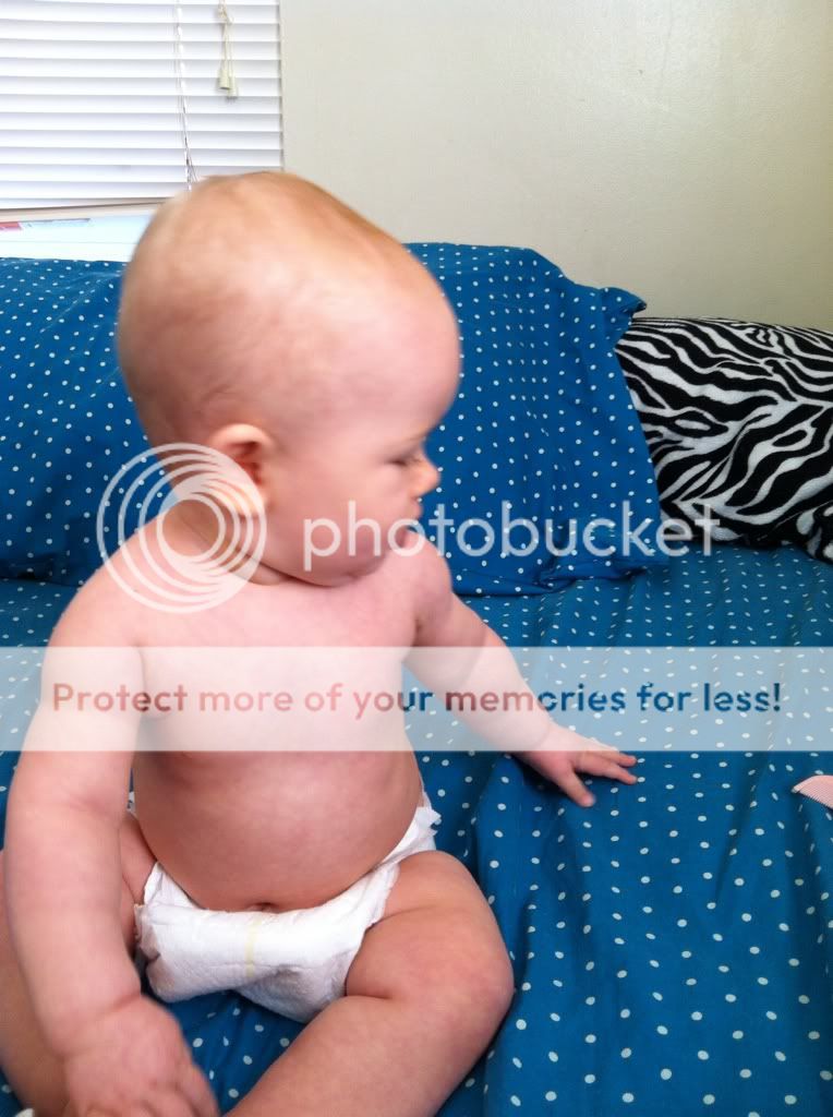 Does your babies head indent? (Pics) BabyCenter